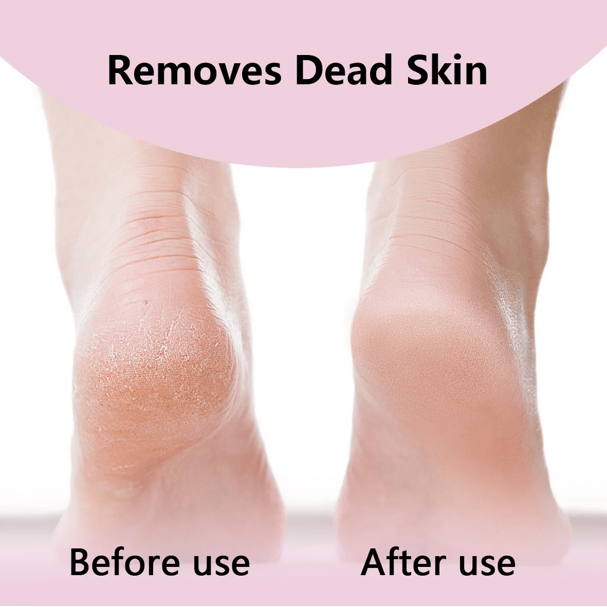 Fifaytech™ Electric Foot Grinder