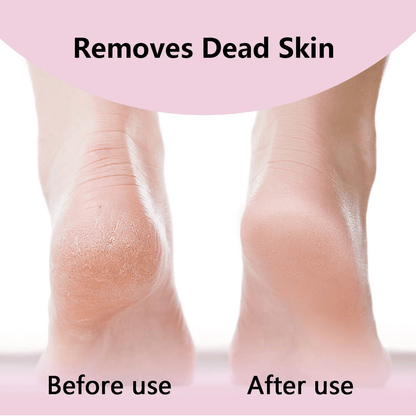 Fifaytech™ Electric Foot Grinder