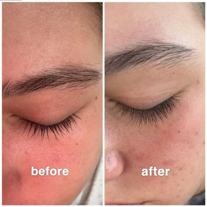 Eyelash Growth Serum