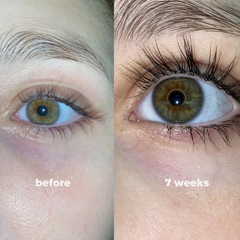 Eyelash Growth Serum