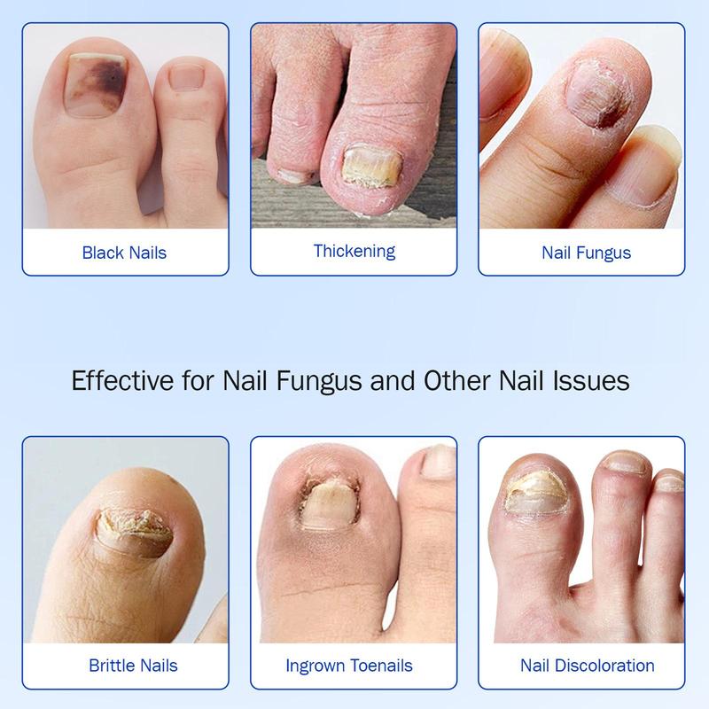 Fifaytech™ Fungal Nail Patches(21pcs/box )