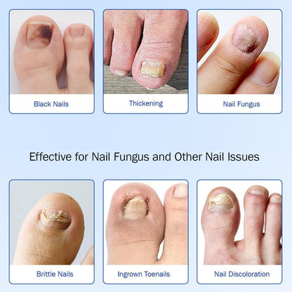 Fifaytech™ Fungal Nail Patches(21pcs/box )